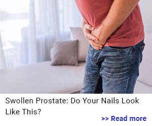 ProstaStream Product
